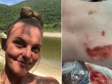 Capivara ataca mulher (Foto: )