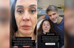 Claudia Raia exibe transformação após procedimento estético